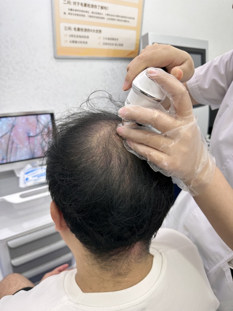 專業頭皮檢測