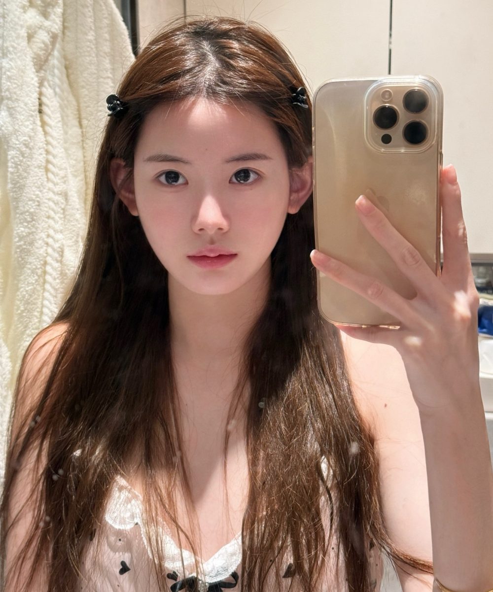 深圳不剃髮植髮適合所有女性嗎？解析適應症與限制