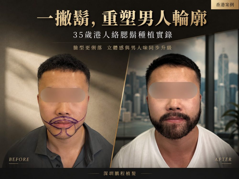 艺术种植|重塑男性輪廓美學：長臉男神的「鬍鬚改造計劃」